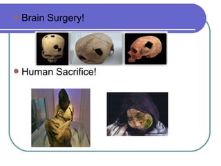 Brain Surgery!
Human Sacrifice!
 