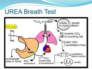 UREA Breath Test
 