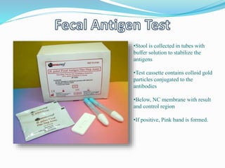 •Stool is collected in tubes with
buffer solution to stabilize the
antigens
•Test cassette contains colloid gold
particles conjugated to the
antibodies
•Below, NC membrane with result
and control region
•If positive, Pink band is formed.
 