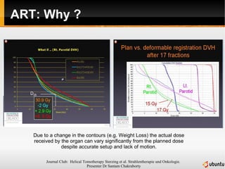 ART: Why ? Due to a change in the contours (e.g. Weight Loss) the actual dose received by the organ can vary significantly from the planned dose despite accurate setup and lack of motion. 