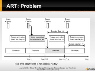ART: Problem Real time adaptive RT is not possible “today” 