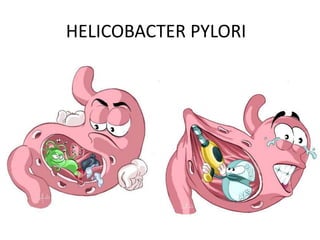 HELICOBACTER PYLORI
 