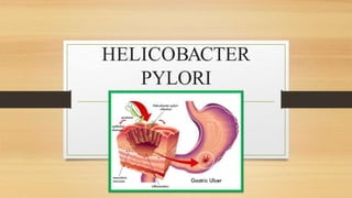 HELICOBACTER
PYLORI
 