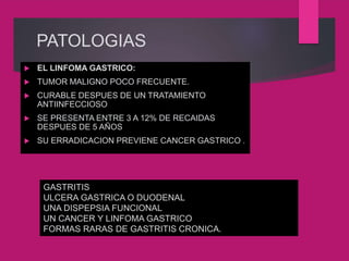 PATOLOGIAS
 EL LINFOMA GASTRICO:
 TUMOR MALIGNO POCO FRECUENTE.
 CURABLE DESPUES DE UN TRATAMIENTO
ANTIINFECCIOSO
 SE PRESENTA ENTRE 3 A 12% DE RECAIDAS
DESPUES DE 5 AÑOS
 SU ERRADICACION PREVIENE CANCER GASTRICO .
GASTRITIS
ULCERA GASTRICA O DUODENAL
UNA DISPEPSIA FUNCIONAL
UN CANCER Y LINFOMA GASTRICO
FORMAS RARAS DE GASTRITIS CRONICA.
 