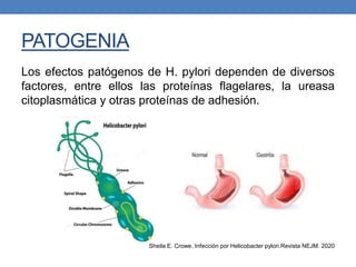 PATOGENIA
Los efectos patógenos de H. pylori dependen de diversos
factores, entre ellos las proteínas flagelares, la ureasa
citoplasmática y otras proteínas de adhesión.
Sheila E. Crowe. Infección por Helicobacter pylori.Revista NEJM. 2020
 