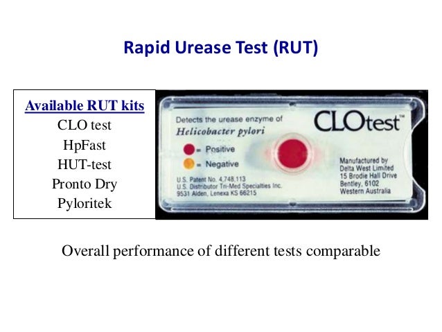 urease test