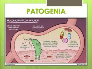 PATOGENIA
 