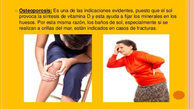 La psoriasis no aparecía