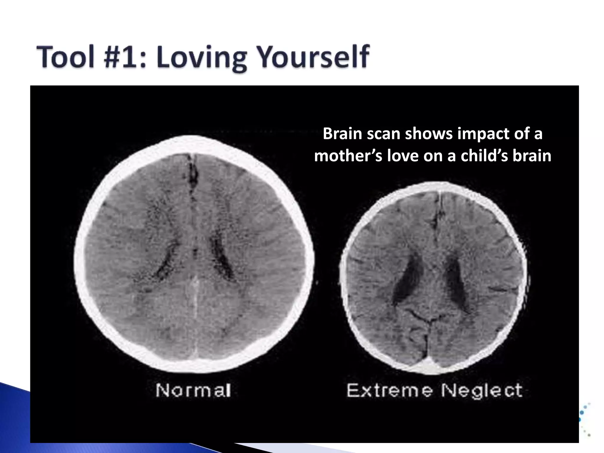 Brain scan shows impact of a 
mother’s love on a child’s brain 
 