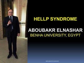 HELLP SYNDROME
ABOUBAKR ELNASHAR
BENHA UNIVERSITY, EGYPT
ABOUBAKR ELNASHAR
 