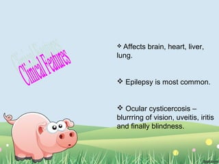  Affects brain, heart, liver,
lung.
 Epilepsy is most common.
 Ocular cysticercosis –
blurrring of vision, uveitis, iritis
and finally blindness.
 