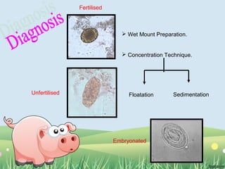 Wet Mount Preparation.
 Concentration Technique.
Floatation SedimentationUnfertilised
Fertilised
Embryonated
 