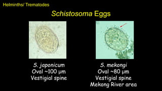 Schistosoma Eggs
Helminths/ Trematodes
S. mekongi
Oval ~80 μm
Vestigial spine
Mekong River area
S. japonicum
Oval ~100 μm
Vestigial spine
 