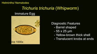 Helminths/ Nematodes
Trichuris trichuria (Whipworm)
Diagnostic Features
- Barrel shaped
- 55 x 25 μm
- Yellow-brown thick shell
- Translucent knobs at ends
Immature Egg
Iodine 1000x
 