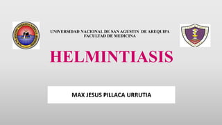 UNIVERSIDAD NACIONAL DE SAN AGUSTIN DE AREQUIPA
FACULTAD DE MEDICINA
HELMINTIASIS
MAX JESUS PILLACA URRUTIA
 