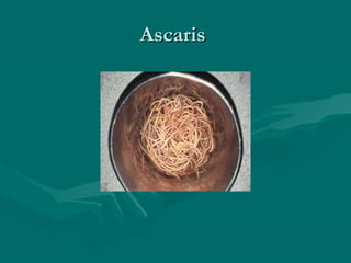 Ascaris
 