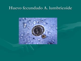 Huevo fecundado A. lumbricoide
 