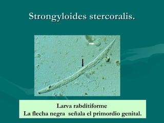 Strongyloides stercoralis.




            Larva rabditiforme
La flecha negra señala el primordio genital.
 