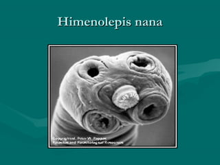 Himenolepis nana
 