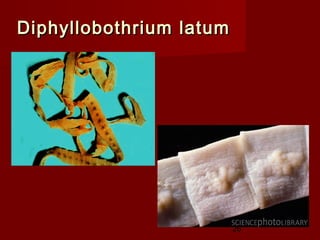 Diphyllobothrium latum




                         26
 