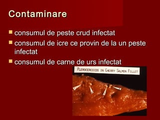 Contaminare
 consumul de peste crud infectat
 consumul de icre ce provin de la un peste
  infectat
 consumul de carne de urs infectat




                                    28
 