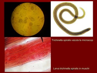 Trichinella spiralis vazuta la microscop




 Larva trichinella 38
                   spiralis in muschi
 