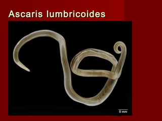 Ascaris lumbricoides




                       47
 