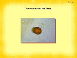 Ovo encontrado nas fezes Fotografado por Tamiris Ferrarezi Taenia  sp 