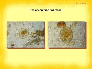 Hymenolepis nana Fotografado por  Tamiris Ferrarezi Fotografado por  Tamiris Ferrarezi Ovo encontrado nas fezes 