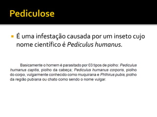  É uma infestação causada por um inseto cujo
nome científico é Pediculus humanus.
 