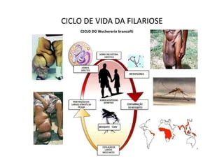 CICLO DE VIDA DA FILARIOSE
 