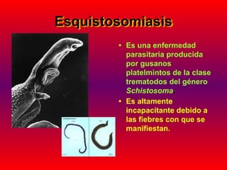 Esquistosomiasis
• Es una enfermedad
parasitaria producida
por gusanos
platelmintos de la clase
trematodos del género
Schistosoma.
• Es altamente
incapacitante debido a
las fiebres con que se
manifiestan.
 