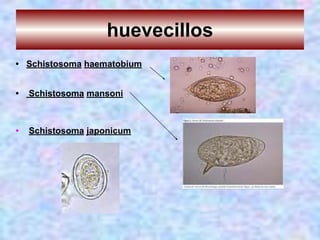 huevecillos
• Schistosoma haematobium
• Schistosoma mansoni
• Schistosoma japonicum
 