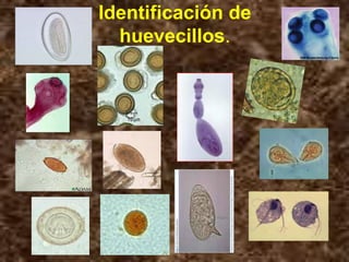 Identificación de
huevecillos.
 