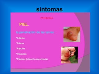 síntomas
 