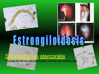 Strongyloides stercoralis
*Cuando las larvas son expulsados, infectan penetrando piel.
 