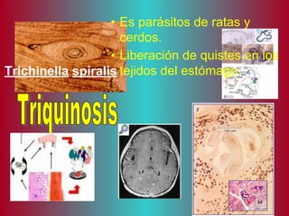 Trichinella spiralis
• Es parásitos de ratas y
cerdos.
• Liberación de quistes en los
tejidos del estómago.
 