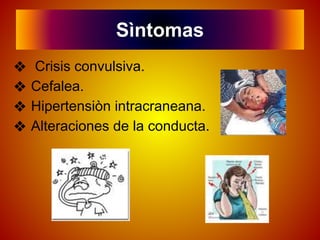 Sìntomas
❖ Crisis convulsiva.
❖ Cefalea.
❖ Hipertensiòn intracraneana.
❖ Alteraciones de la conducta.
 