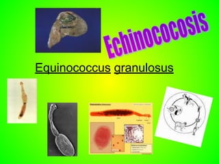 Equinococcus granulosus
 