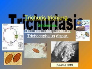 Trichuris trichiura
Sinónimos:
Trichocephalus trichiurus.
Trichocephalus dispar.
Prolapso rectal
 
