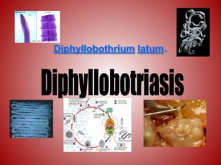 Diphyllobothrium latum.
 