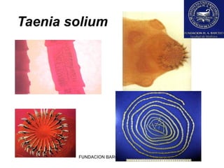 Taenia solium




        FUNDACION BARCELO FACULTAD DE MEDICINA
 