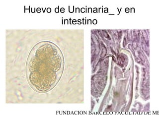 Huevo de Uncinaria_ y en
       intestino




      FUNDACION BARCELO FACULTAD DE ME
 