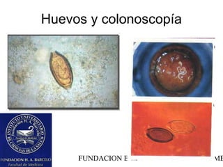 Huevos y colonoscopía




     FUNDACION BARCELO FACULTAD DE ME
 