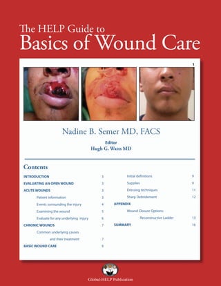 The HELP Guide to

Basics of Wound Care
1

Nadine B. Semer MD, FACS
Editor

Hugh G. Watts MD

Contents
INTRODUCTION

3

Initial definitions

9

EVALUATING AN OPEN WOUND

3

Supplies

9

ACUTE WOUNDS

3

Dressing techniques

11

Patient information

3

Sharp Debridement

12

Events surrounding the injury

4

Examining the wound

5

Evaluate for any underlying injury

6

CHRONIC WOUNDS

7

APPENDIX
Wound Closure Options:
Reconstructive Ladder
SUMMARY

Common underlying causes
and their treatment
BASIC WOUND CARE

7
9

Global-HELP Publication

13
16

 