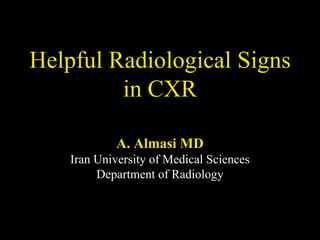 Helpful Radiological Signs
in CXR
A. Almasi MD
Iran University of Medical Sciences
Department of Radiology

 