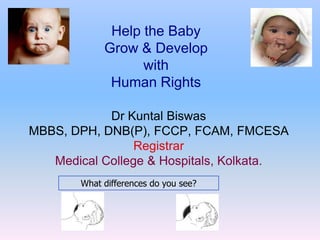 Help the Baby
            Grow & Develop
                  with
             Human Rights

            Dr Kuntal Biswas
MBBS, DPH, DNB(P), FCCP, FCAM, FMCESA
                 Registrar
   Medical College & Hospitals, Kolkata.
       What differences do you see?
 