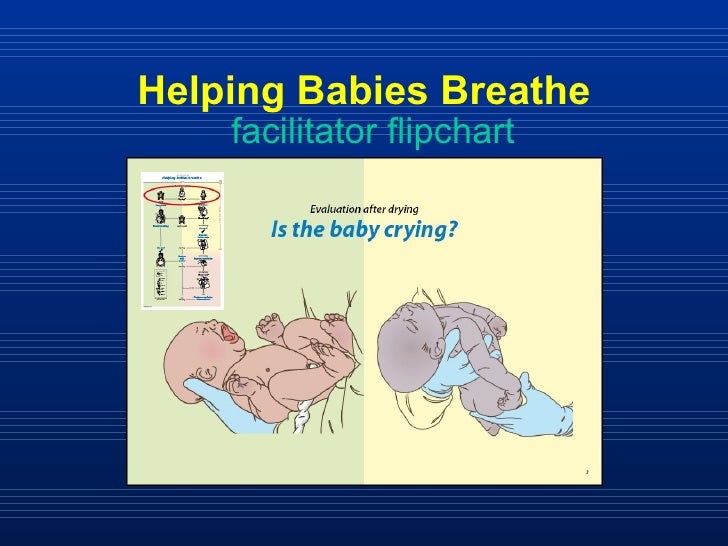 Helping Babies Breathe Facilitator Flip Chart
