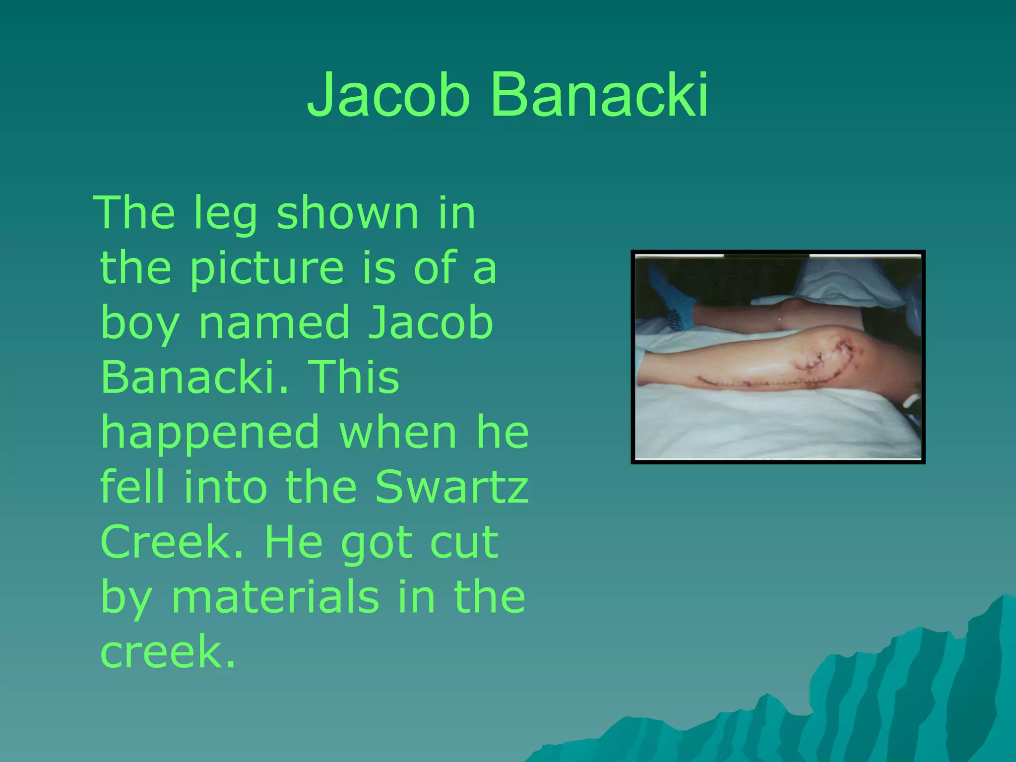 Jacob Banacki The leg shown in the picture is of a boy named Jacob Banacki. This happened when he fell into the Swartz Creek. He got cut by materials in the creek.  