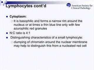 Lymphocytes cont’d
 Cytoplasm:
 It is basophilic and forms a narrow rim around the
nucleus or at times a thin blue line only with few
azurophilic red granules
 N:C ratio is 4:1
 Distinguishing characteristics of a small lymphocyte:
 clumping of chromatin around the nuclear membrane
may help to distinguish this from a nucleated red cell
 